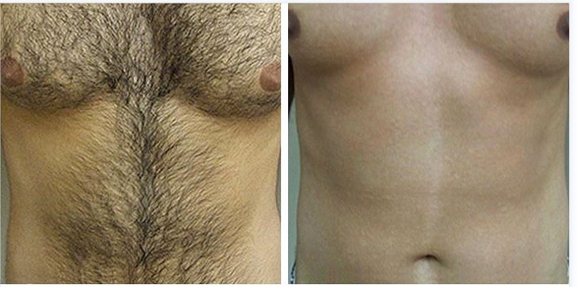 LG~9MA1S}ZN}CTGJX%Z%I$9