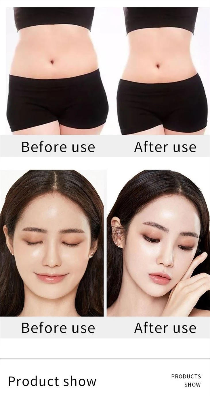 Bipolar RF Ultrasonic Liposuction Cavitation Vacuum Laser Slimming Machine