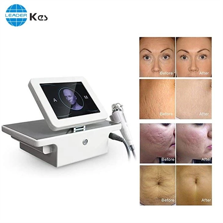 Rf Microneedle Rf Microneedling Machine Salon Sử dụng Thiết bị Nâng cơ mặt bằng Microneedle Fractional di động