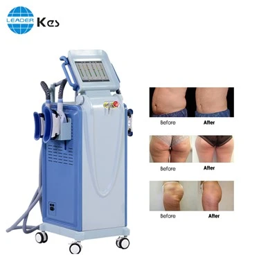 Máy giảm béo đông lạnh