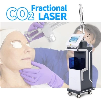ống rf Máy Laser trẻ hóa âm đạo KES